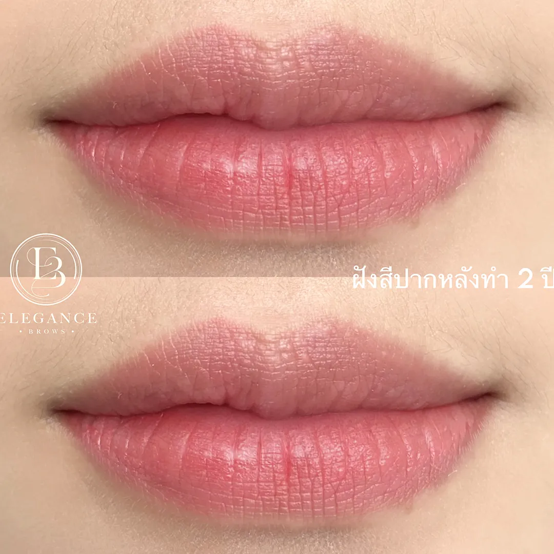 ฝังสีปาก (4)_4